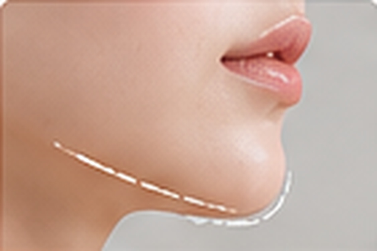 사각턱